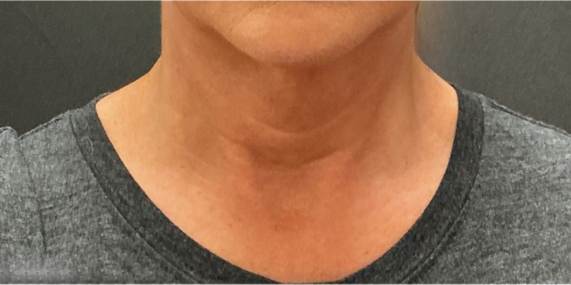 Skin care products before & after photo