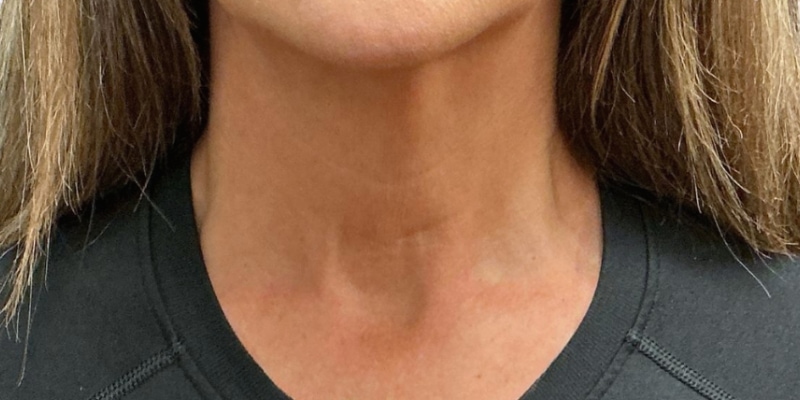 Skin care products before & after photo